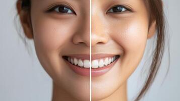 Comparison of facial complexion before and after whitening. photo