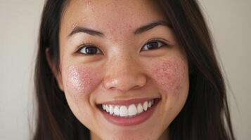 Close-up portrait of a person with facial skin irritation. photo