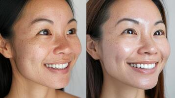 A woman with freckles before and after using a skin care product photo