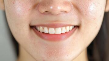 Close-up view of a person's smiling face and teeth. photo
