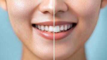 A woman with a smile before and after a teeth whitening treatment photo