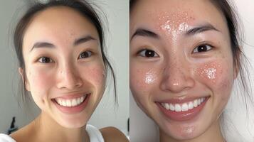 Comparison of facial skin before and after application of skincare product. photo