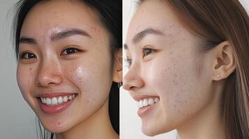 Before and after facial skin improvement, side-by-side comparison. photo