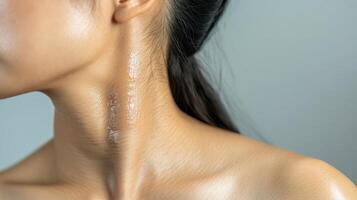 A woman with a white patch on her neck photo