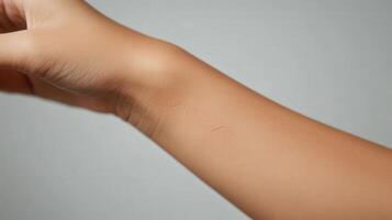 Close-up view of light skin with faint reddish marks on the forearm. photo