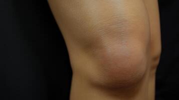 Close-up view of a human knee joint with visible skin texture. photo