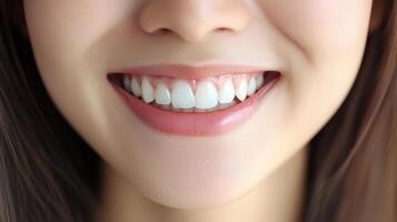Close-up view of a smiling person's healthy teeth and lips. q photo