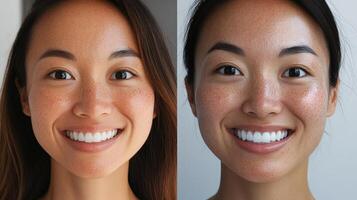 Before and after facial skin improvement comparison photo
