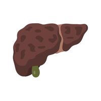 Structure and color of the liver in cirrhosis caused by regular alcohol consumption. vector