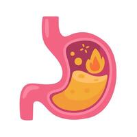 Structure showing the digestive process of the stomach. Cartoon style anatomy study. vector