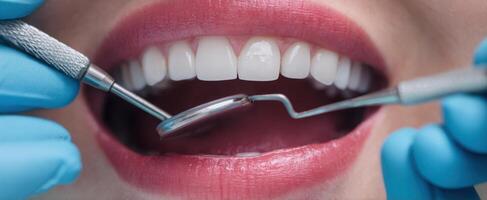 The Dentist Examining a Patient's Bright Smile with Precision Tools photo