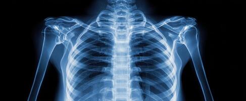 The detailed x-ray image showcasing the human skeletal system and ribcage. photo