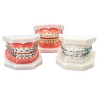 Orthodontic brackets showing different types of braces on transparent background png