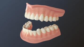 Detailed view of human dental models showcasing upper and lower teeth alignment in a clinical setting photo