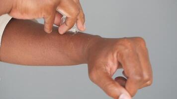 man applying ice on hand video