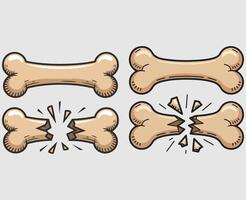 Broken or Fractured Bone vector