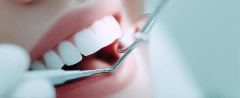 The patient's bright smile during a dental examination with professional tools. photo