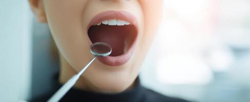 The woman in dental examination with open mouth and professional tools. photo