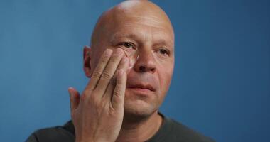 A bald man with his hand on his face photo