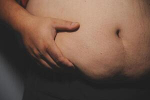 A man's stomach with a large belly photo
