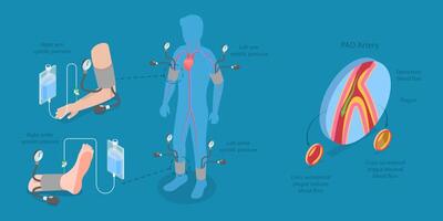 3D Isometric Flat Illustration of ABI Test, Limb Ischemia Diagnosis vector