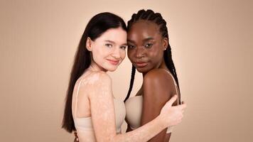 Different Beauty. Young Black Lady And Woman With Vitiligo Disorder Posing Together Over Beige Background In Studio, Body Positive Multiracial Females Wearing Bra's And Smiling At Camera, Copy Space photo