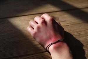 Hand with sunburn marks resting on a wooden table in soft afternoon light photo