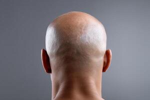 Close view of a bald man's head showing smooth scalp and neck in a neutral backdrop photo