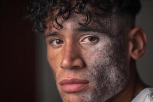 Young man with ash facial markings reflects on his experience in a cultural ritual photo