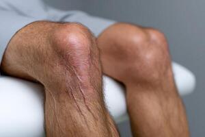 Close-up of a man's knee showing scars and texture during a medical consultation at a clinic photo