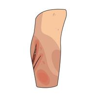 Illustration of wound vector