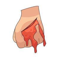 Illustration of wound on hand vector