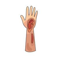Illustration of wound hand vector