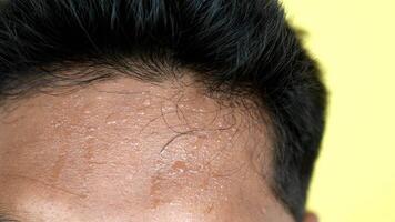 closeup of sweating on man forehead video