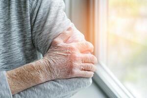 Senior individual showcasing shingles rash while sitting by bright window in warm indoor setting photo