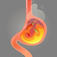 A fiery stomach inflamed by chili a striking image of how spicy food can trigger acid reflux. vector