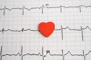 Red heart on electrocardiogram ECG with red heart, heart wave heart attack photo