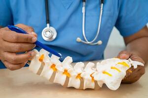 Doctor with lumbar vertebra bone skeleton and nerve model for treatment in orthopedic photo