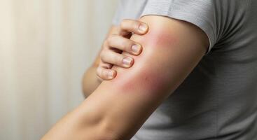 Close up of a person arm with a large red inflamed area, showing symptoms of an allergic reaction or skin irritation. photo