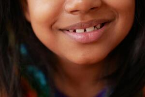 Smiling child with missing teeth shows joy and innocence photo