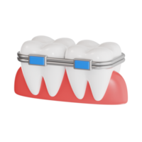 Orthodontic Braces on Teeth 3D Render png