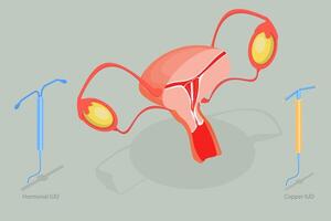 3D Isometric Flat Conceptual Illustration of Intrauterine Device, Birth Control vector