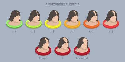 3D Isometric Flat Conceptual Illustration of Androgenic Alopecia, Balding Progress vector