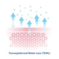 The mechanism of transepidermal water loss illustration on white background. TEWL is the process where water evaporates from the skin surface, leading to dehydration and compromised skin barrier. vector