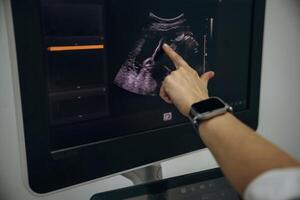 Woman is pointing the finger at display of ultrasonic device in the clinic photo