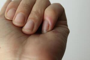 A close-up of a woman's left hand. Hand care. Close-up photo