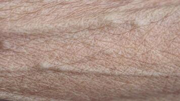 Dry Skin texture close-up reveals unique patterns and details video