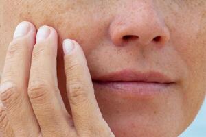 Close-up of woman touching her cheek with fingers showing natural skin texture and freckles photo