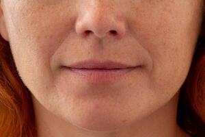 Close up of cropped middle aged caucasian woman face showing nasolabial folds and skin texture photo