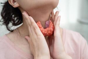 Hyperthyroidism Overactive Thyroid, Thyroid Lymphoma, Asian woman with thyroid gland photo